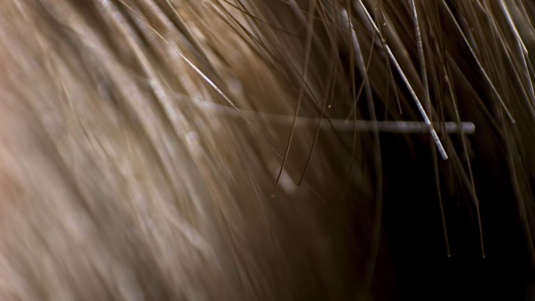 Gros plan sur une chevelure brune illustrant un article sur la carence en fer et la chute de cheveux